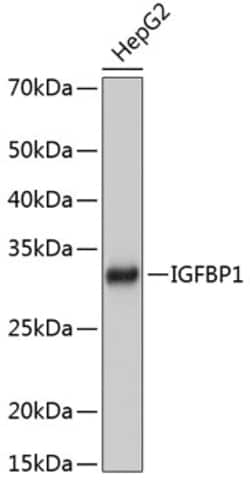 Invitrogen IGFBP-1 Recombinant Rabbit Monoclonal Antibody (2A0B5) 100 &mu;L;