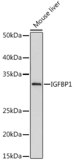 Invitrogen IGFBP-1 Recombinant Rabbit Monoclonal Antibody (2A0B5) 100 &mu;L;