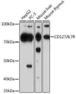 Invitrogen CD127 Recombinant Rabbit Monoclonal Antibody (6H0T7) 100 &mu;L | Buy Online | Invitrogen&trade; | Fisher Scientific