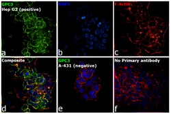 Invitrogen Glypican 3 Recombinant Rabbit Monoclonal Antibody (7M2X9) 100