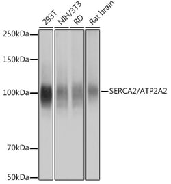 Invitrogen SERCA2 ATPase Recombinant Rabbit Monoclonal Antibody (10F0M9) 100 &mu;L | Buy Online | Invitrogen&trade; | Fisher Scientific