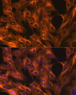 Invitrogen beta Tubulin Recombinant Rabbit Monoclonal Antibody (4E9G8)