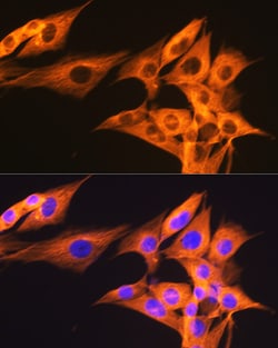 Invitrogen beta Tubulin Recombinant Rabbit Monoclonal Antibody (4E9G8)