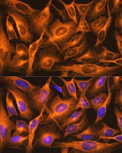 Invitrogen beta Tubulin Recombinant Rabbit Monoclonal Antibody (4E9G8)