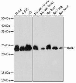 Invitrogen RAB7 Recombinant Rabbit Monoclonal Antibody (5A10A4) 100 &mu;L;