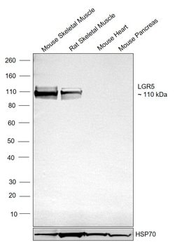 Invitrogen LGR5 Recombinant Rabbit Monoclonal Antibody (9J9B8) 100 &mu;L | Buy Online | Invitrogen&trade; | Fisher Scientific