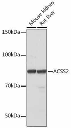 Invitrogen ACSS2 Recombinant Rabbit Monoclonal Antibody (4N5V4) 100 &mu;L;