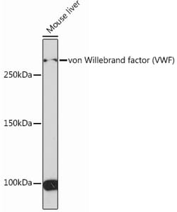 Invitrogen VWF Recombinant Rabbit Monoclonal Antibody (8O6D7) 100 &mu;L;