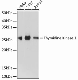 Invitrogen TK1 Recombinant Rabbit Monoclonal Antibody (0V8O2) 100 &mu;L | Buy Online | Invitrogen&trade; | Fisher Scientific