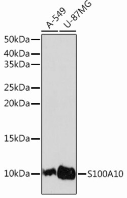 Invitrogen S100A10 Recombinant Rabbit Monoclonal Antibody (6X8F7) 100 &mu;L | Buy Online | Invitrogen&trade; | Fisher Scientific