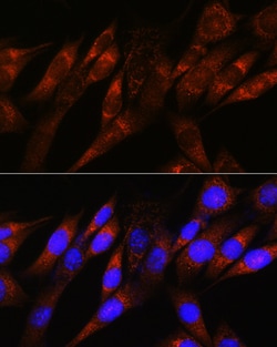 Invitrogen PDHA1 Recombinant Rabbit Monoclonal Antibody (8Z4N6) 100 &mu;L;