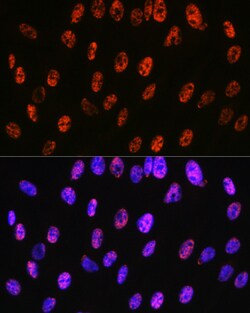 Invitrogen PABPN1 Recombinant Rabbit Monoclonal Antibody (7V4X8) 100 &mu;L;