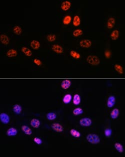 Invitrogen PABPN1 Recombinant Rabbit Monoclonal Antibody (7V4X8) 100 &mu;L;