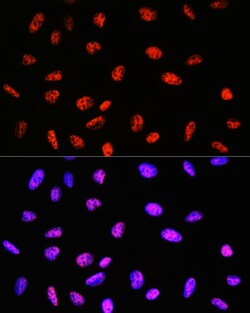 Invitrogen PABPN1 Recombinant Rabbit Monoclonal Antibody (7V4X8) 100 &mu;L;