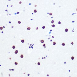 Invitrogen PABPN1 Recombinant Rabbit Monoclonal Antibody (7V4X8) 100 &mu;L;
