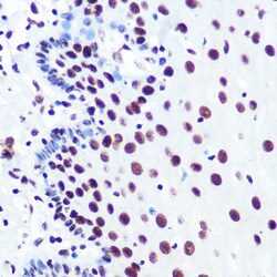 Invitrogen PABPN1 Recombinant Rabbit Monoclonal Antibody (7V4X8) 100 &mu;L;