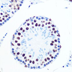 Invitrogen PABPN1 Recombinant Rabbit Monoclonal Antibody (7V4X8) 100 &mu;L;