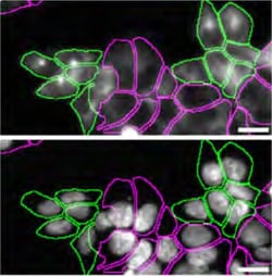 Invitrogen Amyloid Precursor Protein Recombinant Rabbit Monoclonal Antibody