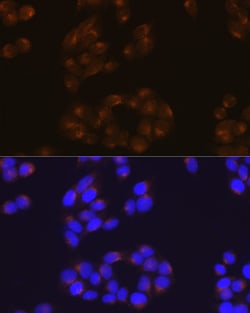 Invitrogen Amyloid Precursor Protein Recombinant Rabbit Monoclonal Antibody