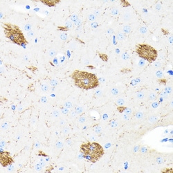 Invitrogen Amyloid Precursor Protein Recombinant Rabbit Monoclonal Antibody