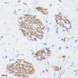 Invitrogen Amyloid Precursor Protein Recombinant Rabbit Monoclonal Antibody