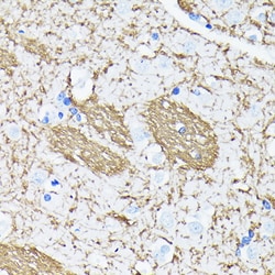 Invitrogen Amyloid Precursor Protein Recombinant Rabbit Monoclonal Antibody