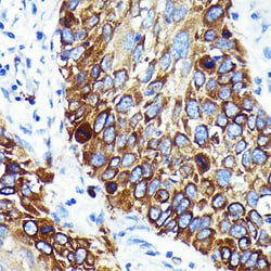 Invitrogen Cathepsin B Recombinant Rabbit Monoclonal Antibody (6I5D7) 100