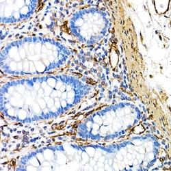 Invitrogen Caveolin 1 Recombinant Rabbit Monoclonal Antibody (10Y5L2) 100