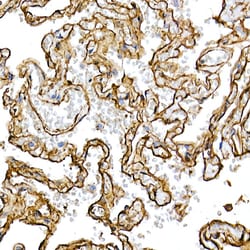 Invitrogen Caveolin 1 Recombinant Rabbit Monoclonal Antibody (10Y5L2) 100