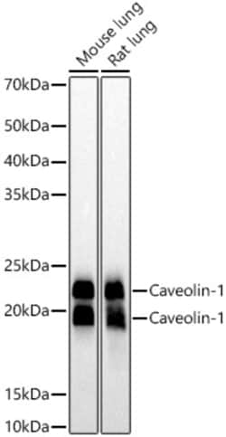 Invitrogen Caveolin 1 Recombinant Rabbit Monoclonal Antibody (10Y5L2) 100