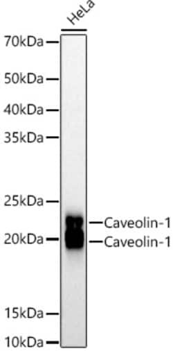 Invitrogen Caveolin 1 Recombinant Rabbit Monoclonal Antibody (10Y5L2) 100