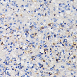 Invitrogen CD11a Recombinant Rabbit Monoclonal Antibody (1Z4B8) 100 &mu;L;