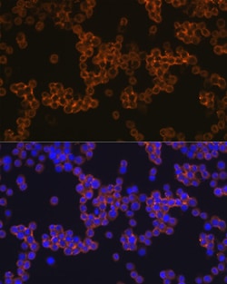 Invitrogen CD14 Recombinant Rabbit Monoclonal Antibody (0F2Q7) 100 &mu;L;