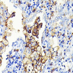 Invitrogen CD14 Recombinant Rabbit Monoclonal Antibody (0F2Q7) 100 &mu;L;