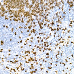 Invitrogen CD3e Recombinant Rabbit Monoclonal Antibody (6G6K9) 100 &mu;L | Buy Online | Invitrogen&trade; | Fisher Scientific