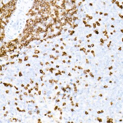 Invitrogen CD3e Recombinant Rabbit Monoclonal Antibody (6G6K9) 100 &mu;L | Buy Online | Invitrogen&trade; | Fisher Scientific
