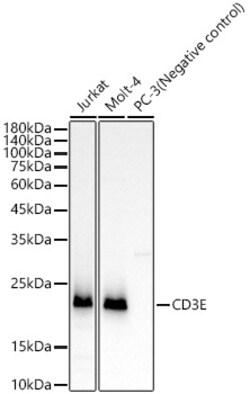 Invitrogen CD3e Recombinant Rabbit Monoclonal Antibody (6G6K9) 100 &mu;L | Buy Online | Invitrogen&trade; | Fisher Scientific