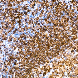 Invitrogen CD79a Recombinant Rabbit Monoclonal Antibody (3G10U6) 100 &mu;L;