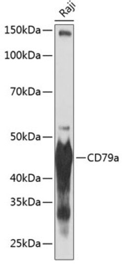 Invitrogen CD79a Recombinant Rabbit Monoclonal Antibody (3G10U6) 100 &mu;L;
