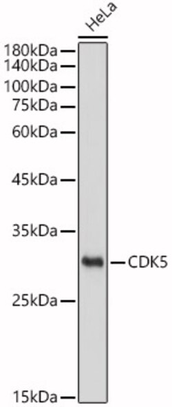 Invitrogen CDK5 Recombinant Rabbit Monoclonal Antibody (7C8T10) 100 &mu;L;