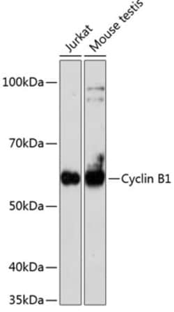 Invitrogen Cyclin B1 Recombinant Rabbit Monoclonal Antibody (1Q3E9) 100 &mu;L | Buy Online | Invitrogen&trade; | Fisher Scientific