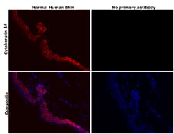 Invitrogen Cytokeratin 14 Recombinant Rabbit Monoclonal Antibody (5Z4O9)
