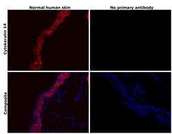 Invitrogen Cytokeratin 14 Recombinant Rabbit Monoclonal Antibody (5Z4O9)