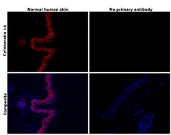 Invitrogen Cytokeratin 14 Recombinant Rabbit Monoclonal Antibody (5Z4O9)