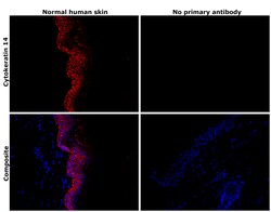 Invitrogen Cytokeratin 14 Recombinant Rabbit Monoclonal Antibody (5Z4O9)