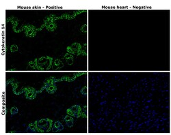 Invitrogen Cytokeratin 14 Recombinant Rabbit Monoclonal Antibody (5Z4O9)