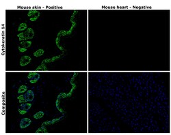 Invitrogen Cytokeratin 14 Recombinant Rabbit Monoclonal Antibody (5Z4O9)
