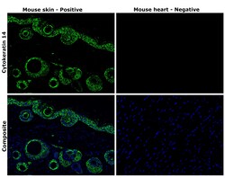 Invitrogen Cytokeratin 14 Recombinant Rabbit Monoclonal Antibody (5Z4O9)