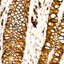 Invitrogen Cytokeratin 20 Recombinant Rabbit Monoclonal Antibody (8C6A3) 100 &mu;L | Buy Online | Invitrogen&trade; | Fisher Scientific
