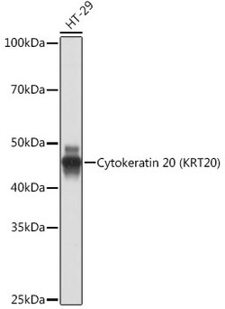 Invitrogen Cytokeratin 20 Recombinant Rabbit Monoclonal Antibody (8C6A3) 100 &mu;L | Buy Online | Invitrogen&trade; | Fisher Scientific